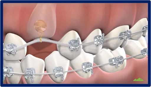 periodontal treatments 1