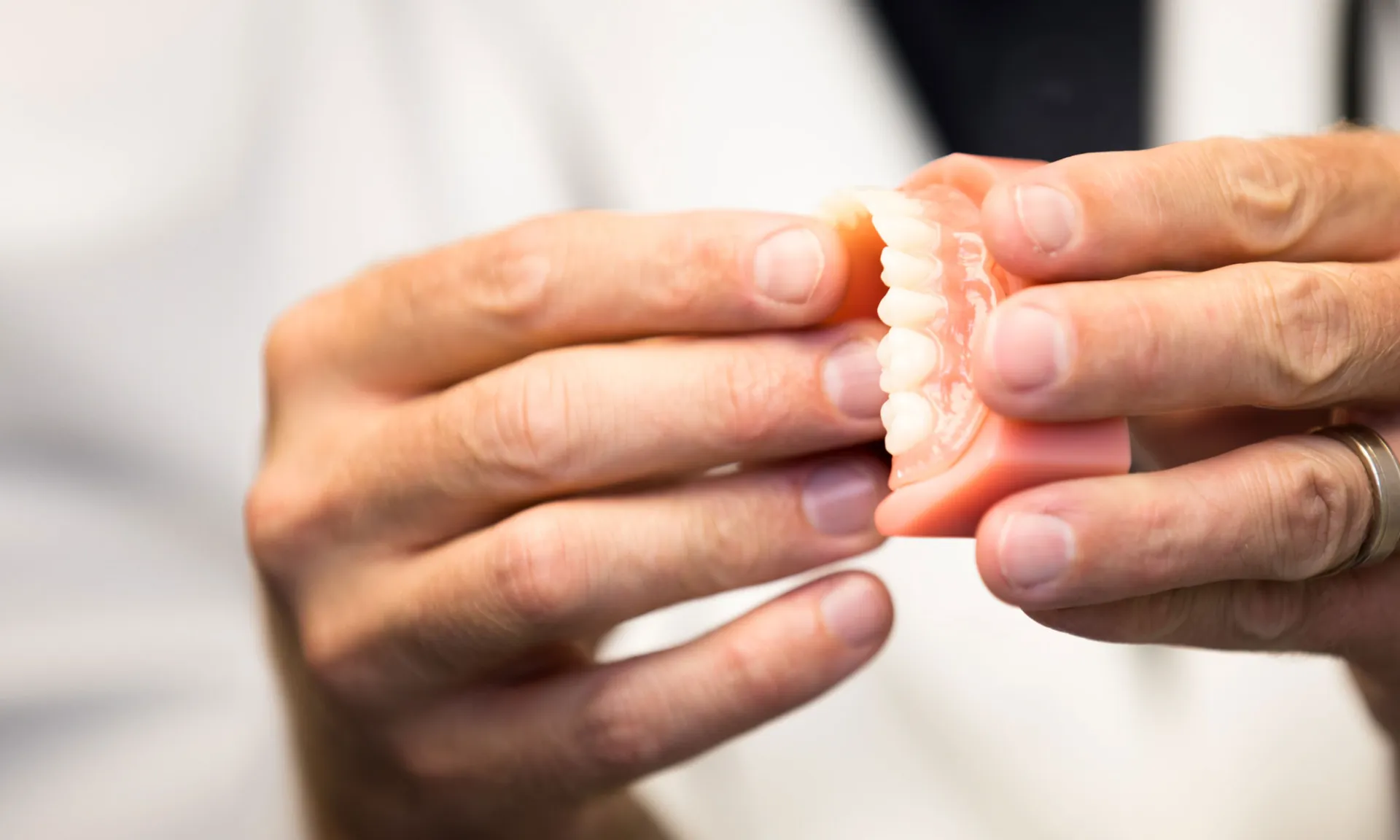 dr bingham holding implant supported dentures model