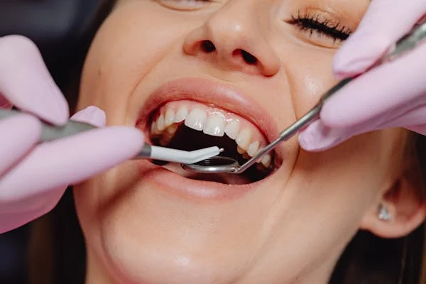 gum disease 2