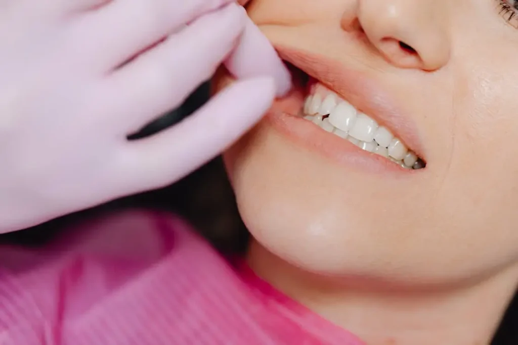 gum recession2