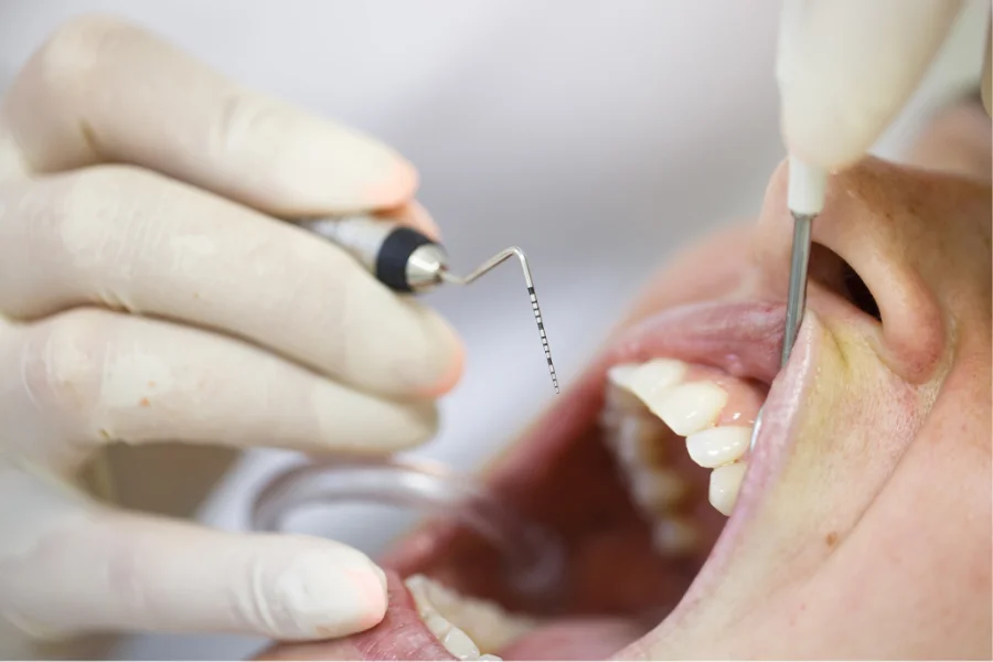 Gum and bone support around a tooth measured during a periodontal exam at Council Oak Perio Austin TX
